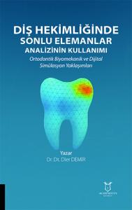 Diş Hekimliğinde Sonlu Elemanlar Analizinin Kullanımı
